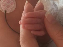 Fundraising Page Image